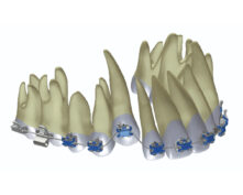 ARCS MEMORIA MOYENS MAX 16X16 (x10)