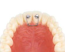 TUBE DB POUR DIASTEME (x10)